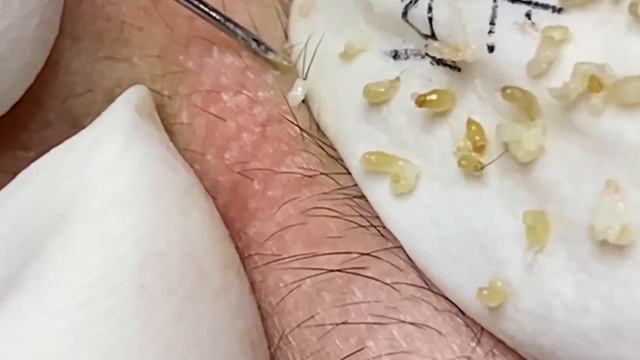 Enjoy Every Day With The Best Video Loan Nguyen Spa Official  2649