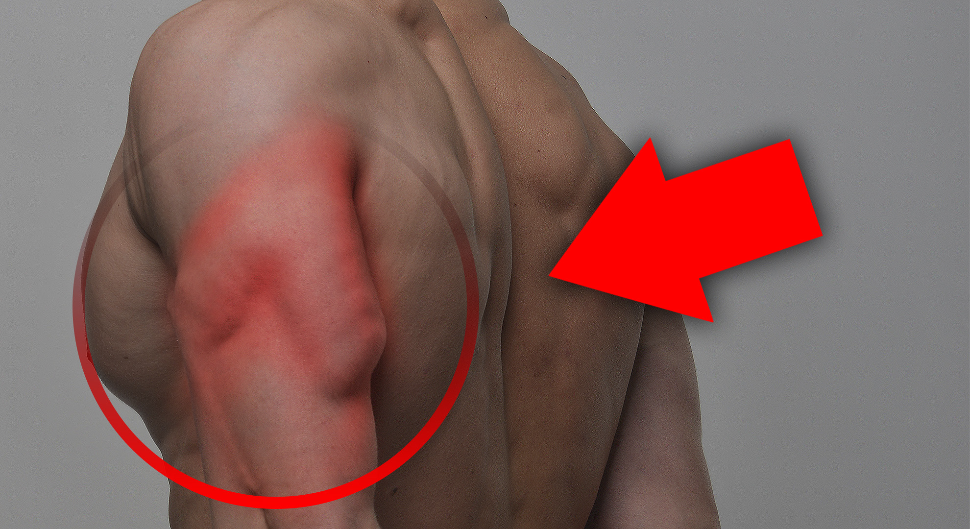 Устраняем хилые трицепсы смотреть онлайн