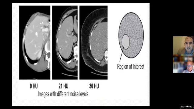 ELP-04 | Lecture-5 | CT Physics Technology Image Quality in CT (indices/parameters/artifacts) смотреть онлайн