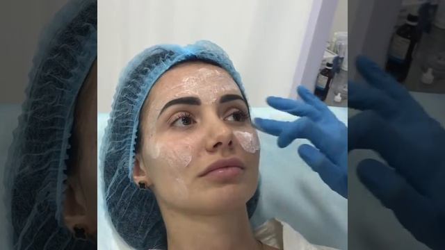 Подготовка к лазерной шлифовке лица СО2 смотреть онлайн