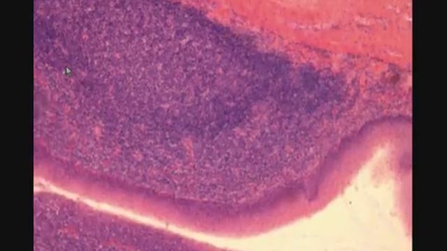 НЕБНАЯ МИНДАЛИНА. PALATINE TONSIL. В световой микроскоп. смотреть онлайн
