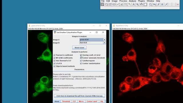 Colocalisation tutorial using ImageJ смотреть онлайн