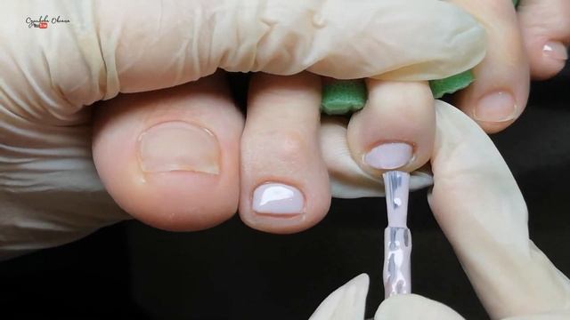 Трещина - ремонт, восстановление ногтя на ноге полигелем. Дизайн ногтей с фольгой и наклейками смотреть онлайн