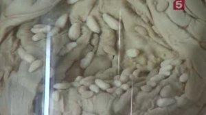 Глисты видео