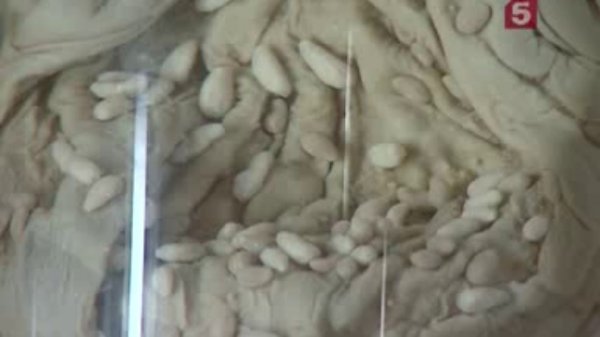 Глисты видео