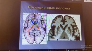 Древний мозг, старый мозг, оболочки головного мозга, боковые желудочки