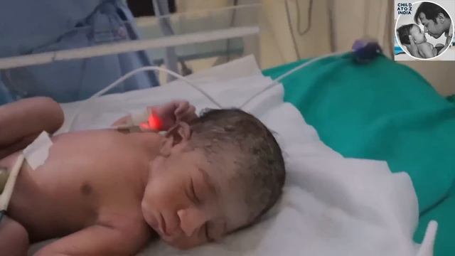 Newborn Baby First 5 Minutes After Birth | जन्म के बाद नवजात शिशु के साथ क्या क्या होता है смотреть онлайн