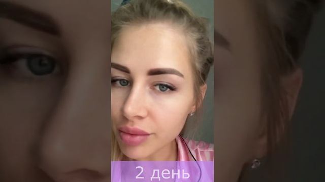 Заживление татуажа бровей по дням. Часть 1 #shorts смотреть онлайн