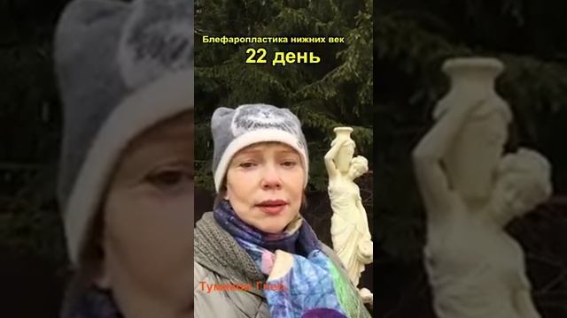 27 марта 2019 г.Блефаропластика, 22-ой день смотреть онлайн