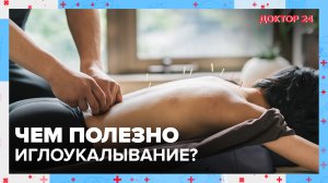 Чем полезно ИГЛОУКАЛЫВАНИЕ? | Доктор 24