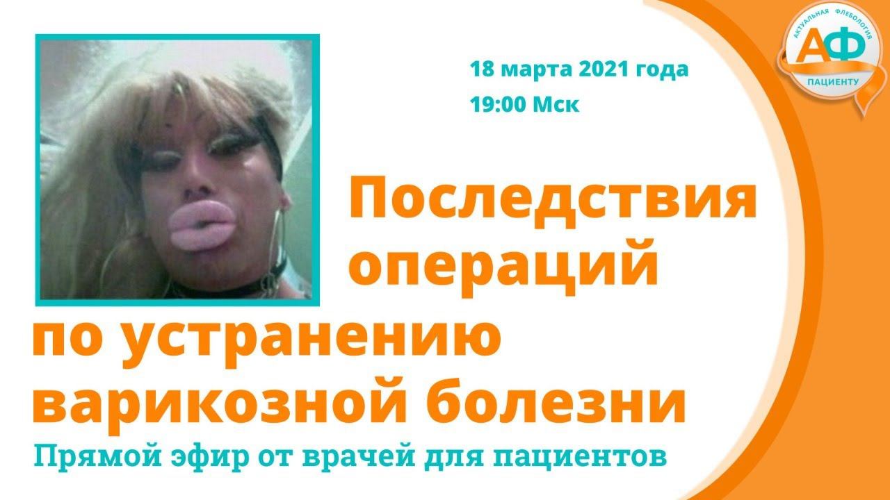 Последствия операций по устранению варикозного расширения вен нижних конечностей смотреть онлайн