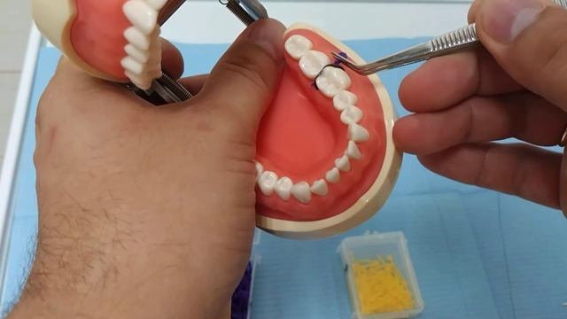 Пластиковые клинья. смотреть онлайн