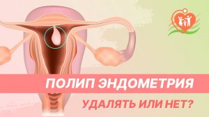 ? Полип эндометрия. Удалять или нет?