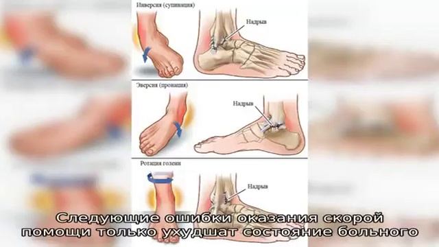 Восстановление связок голеностопа смотреть онлайн