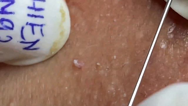 Enjoy Every Day With The Best Video Loan Nguyen Spa Official | 959