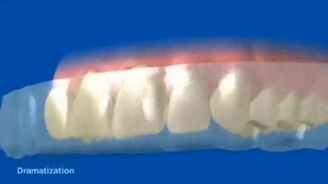 How Crest 3D Whitestrips Work смотреть онлайн