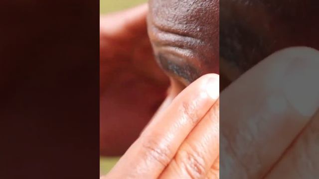 Causas y Síntomas de los Dolores de Cabeza por Sinusitis смотреть онлайн