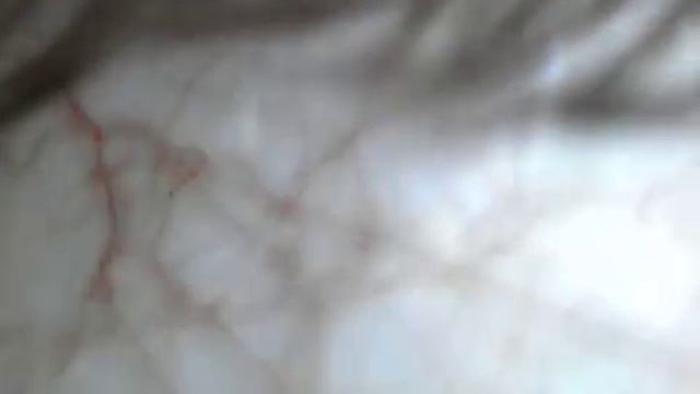 камера юстировка глаз смотреть онлайн