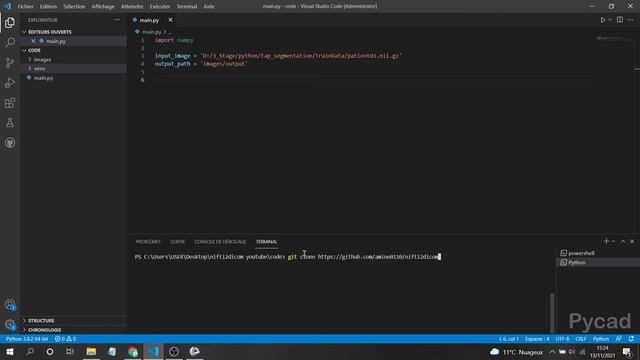 How to Convert a Nifti File into Dicom Series Using Python смотреть онлайн
