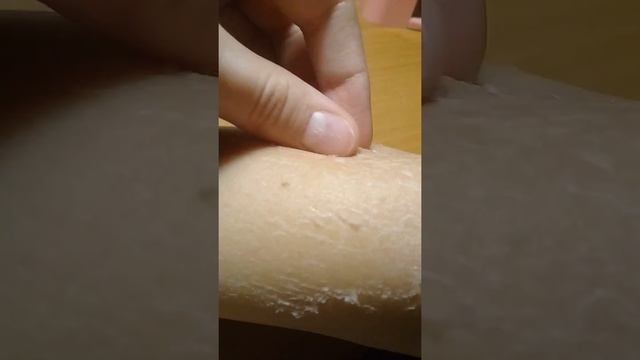 У Кати слазит кожа смотреть онлайн