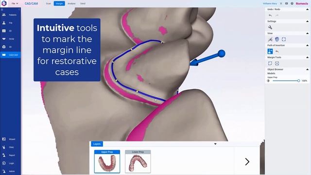 Planmeca Romexis 6.4 highlights смотреть онлайн
