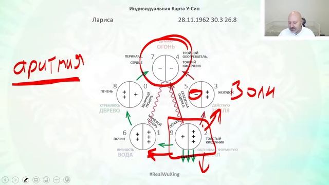 Блиц-Разбор. Психосоматика заболеваний сердца (01216 13 Larisa) смотреть онлайн