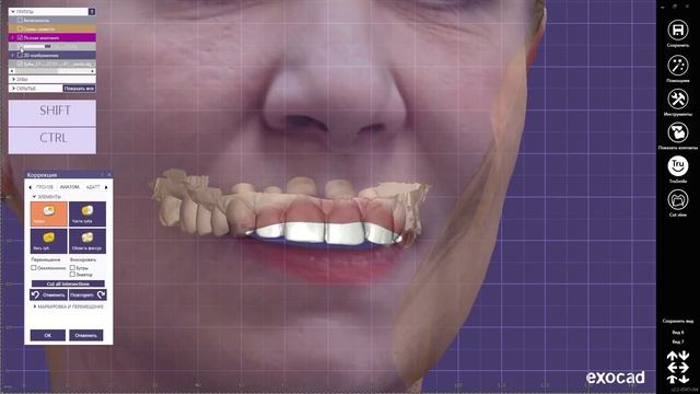 Exocad 3D face scan смотреть онлайн
