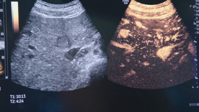 What's new with GE Healthcare - LOGIQ™ E10 | GE Healthcare смотреть онлайн