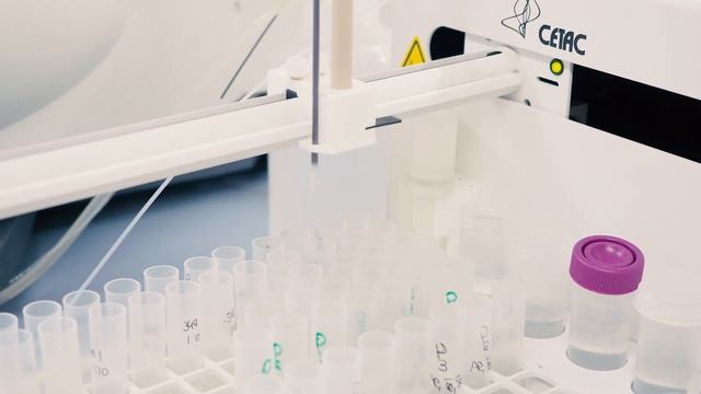 e-globulus смотреть онлайн