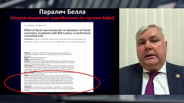 Невропатия лицевого нерва. Современные рекомендации по курации пациентов. Малый совет экспертов