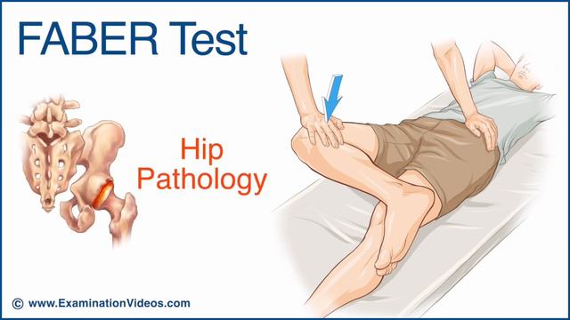 FABER test (Patrick's Test) смотреть онлайн