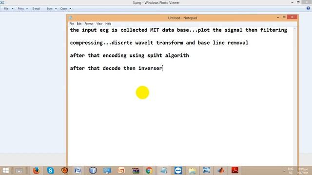 Performance Analysis of ECG Signal Compression using SPIHT|ieee 2017 signal processing projects смотреть онлайн