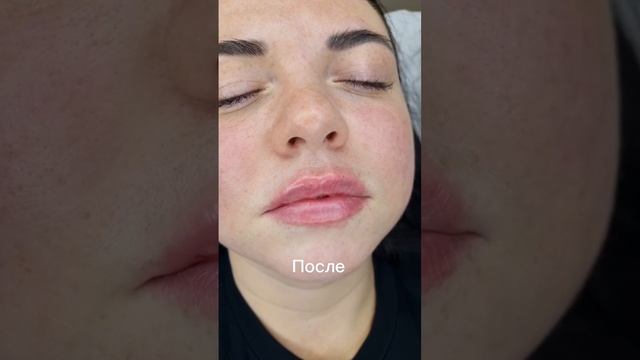 работа с губами #косметология #губы#любимаяработа смотреть онлайн