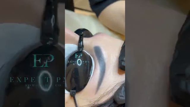 Удаление бровей! Результат после 1 процедуры!