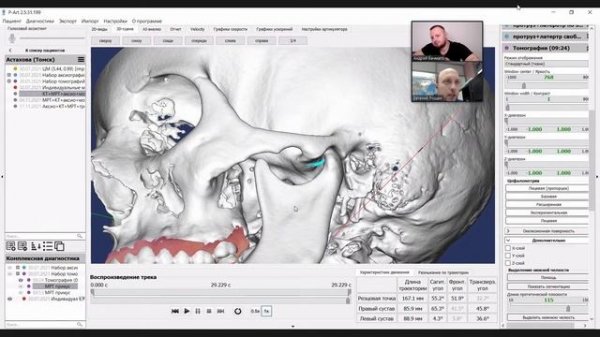 ЕВГЕНИЙ РОЩИН: PROART, АНАЛИЗ КЛКТ, СФЕРА МОНСОНА, ВЫГРУЗКА В EXOCAD И ЦИФРОВОЙ ВАРИАТОР