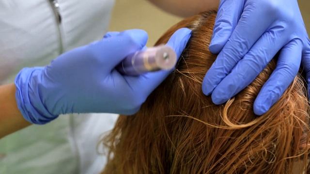 Hair Loss : Prevention and Treatments in Abramski Hair Health Center смотреть онлайн