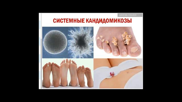 Микозы Комплексная система оздоровления смотреть онлайн