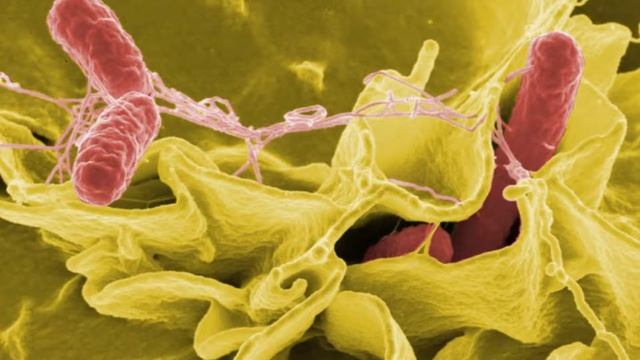 Сальмонеллез симптомы