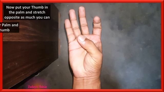 Marfan Syndrome Test | Check Yourself смотреть онлайн