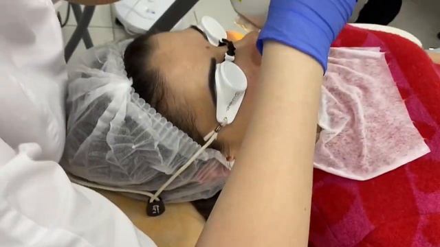 Лечебная косметология на аппарате М22 смотреть онлайн