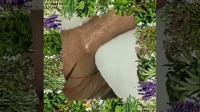 Popping Pimples And Blackheads - 3