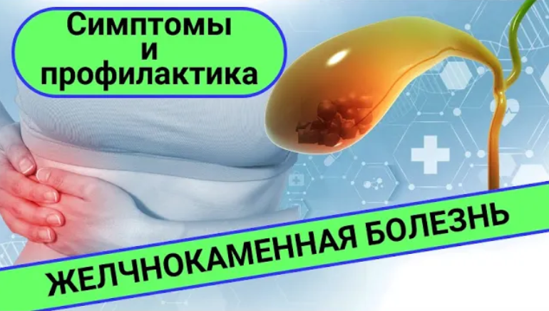 ЖЕЛЧНОКАМЕННАЯ БОЛЕЗНЬ: симптомы и профилактика смотреть онлайн