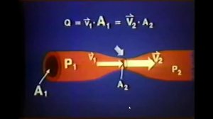 Видеолекция клиники Мэйо  Допплеровское исслед 2 я лекция