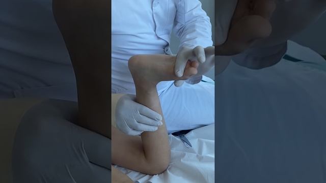 Визит к неврологу / ребенок ходит на цыпочках смотреть онлайн