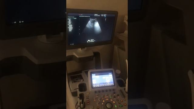Samsung Medison Accuvix A30 Rifmedical смотреть онлайн