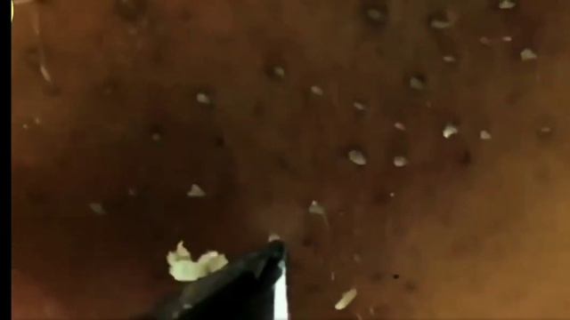 убрать прыщи с носа смотреть онлайн