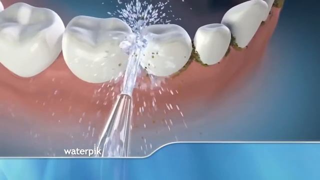 Water Flosser смотреть онлайн