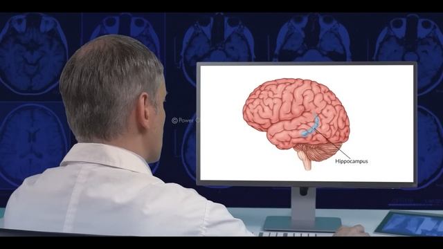 Human Brain: Its parts and functions смотреть онлайн