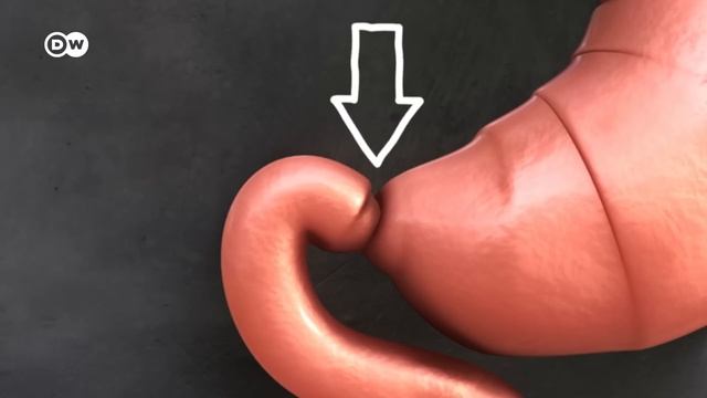 Cómo funciona el estómago | DW En forma смотреть онлайн