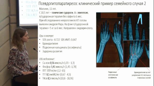 Евсюкова Е.А. Диабетический кетоацидоз: актуальность проблемы. смотреть онлайн